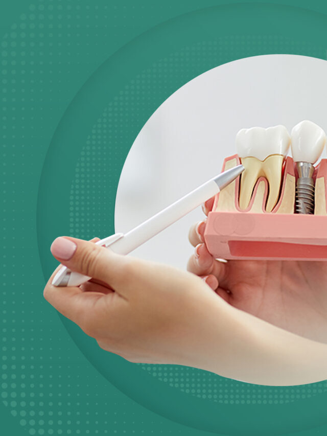 How long does dental implant treatment take?